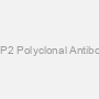 JDP2 Polyclonal Antibody